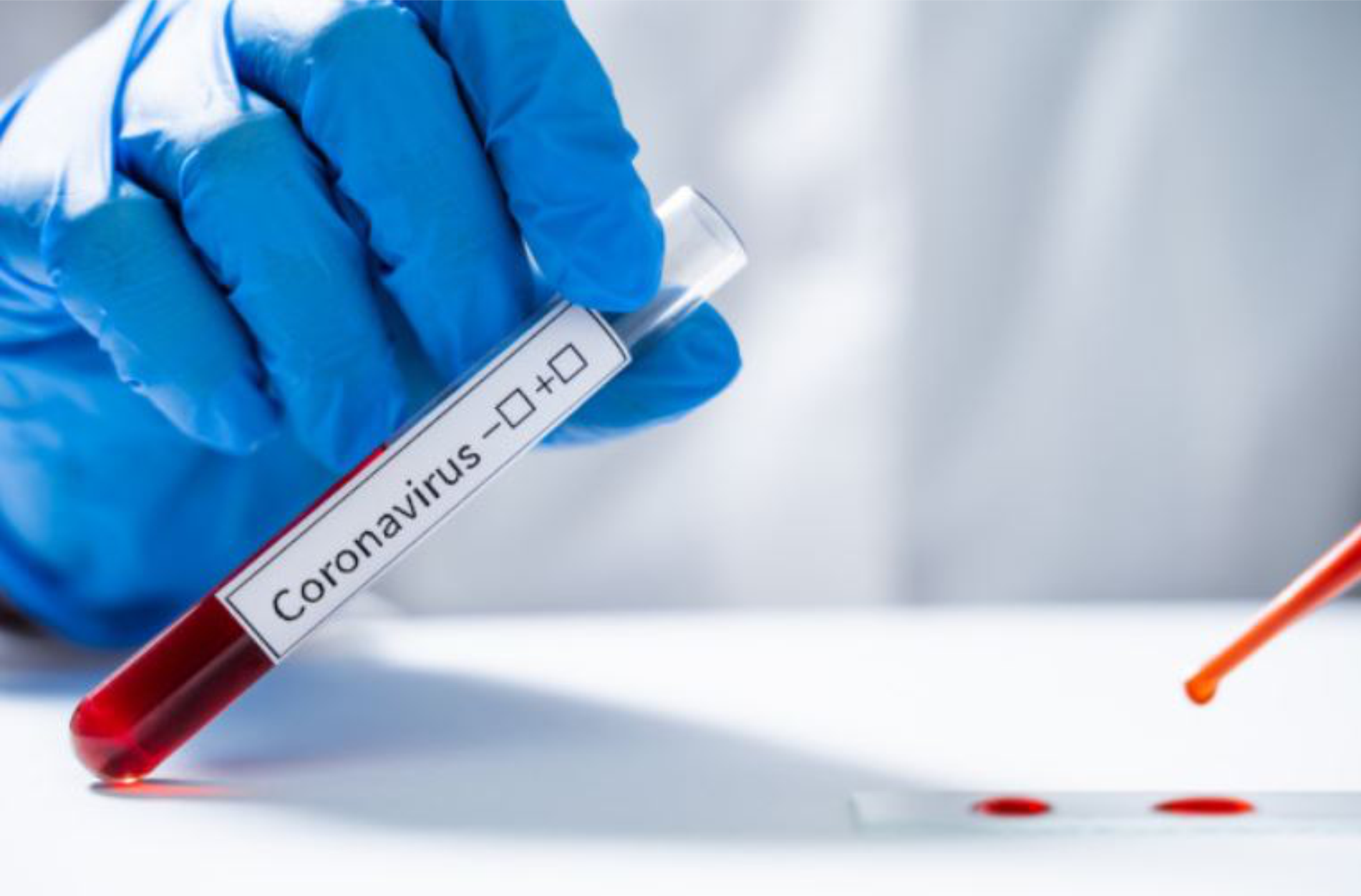 ООО «Зейтун Фармасьютикалс» предоставило Министерству здравоохранения 50 000 бесплатных наборов для тестирования ПЦР для тестирования на вирус COVID-19